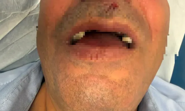 Bus driver assaulted in Jerusalem: ‘I was beaten and lost consciousness’