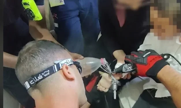Child’s hand gets caught in a mixer beater