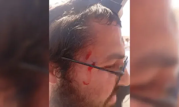 Jewish hikers attacked after mistakenly entering Arab village