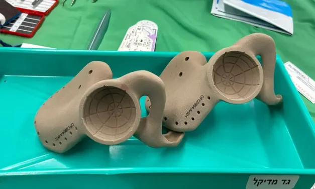 Medical History: Israeli surgeons replace teenager’s pelvis in 19-hour operation
