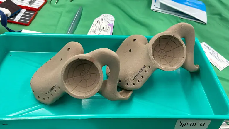Medical History: Israeli surgeons replace teenager’s pelvis in 19-hour operation