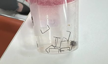 Six-month-old baby receives surgery months after swallowing package of staples