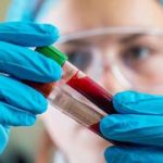 For the first time, new blood test can help detect Alzheimer’s from age 40
