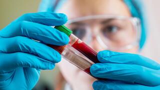 For the first time, new blood test can help detect Alzheimer’s from age 40