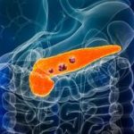 FDA approves breakthrough drug for metastatic pancreatic cancer: ‘A real revolution’