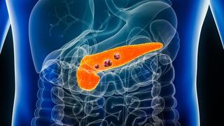 FDA approves breakthrough drug for metastatic pancreatic cancer: ‘A real revolution’