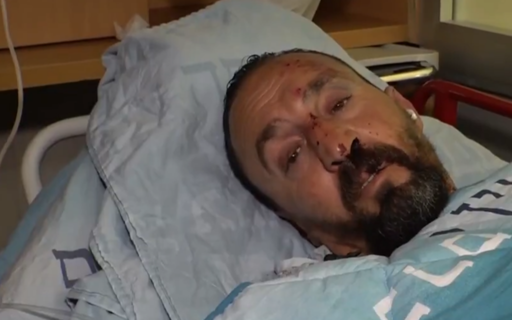Arab bus driver beaten unconscious in Beit Shemesh after refusing to stop between stations