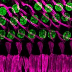 Israeli scientists help solve genetic mystery linking hearing loss and gray hair
