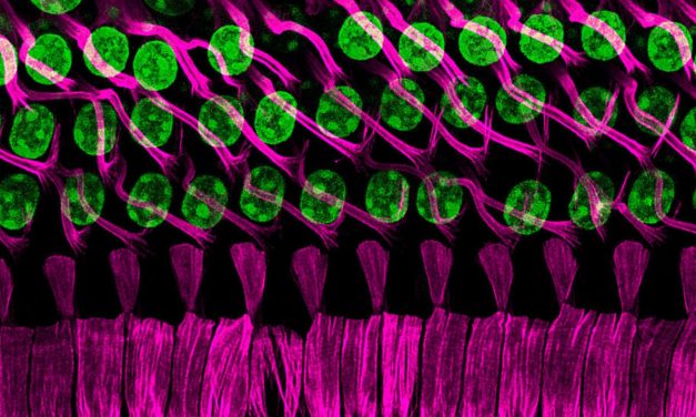 Israeli scientists help solve genetic mystery linking hearing loss and gray hair