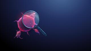 Why immunotherapy works for some cancer patients but not others
