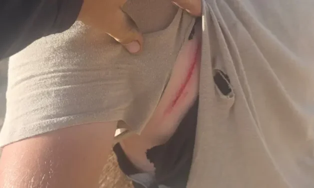 Hikers attacked in Samaria: ‘They beat us with clubs and filmed us’