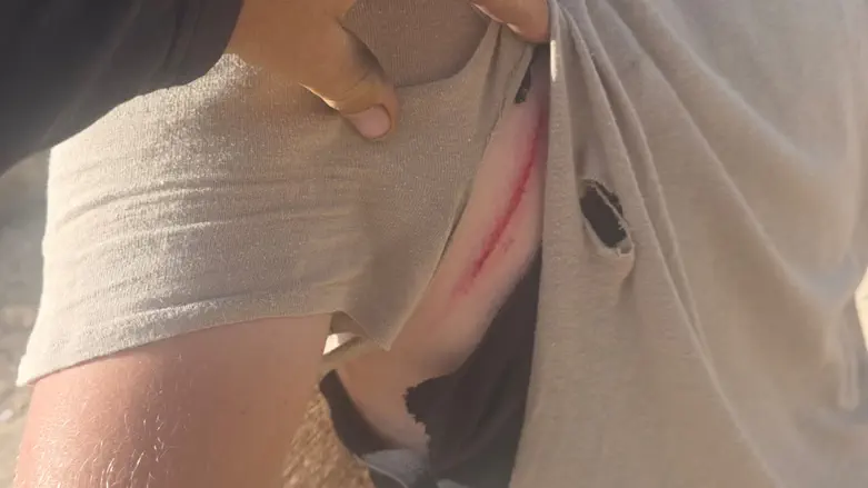 Hikers attacked in Samaria: ‘They beat us with clubs and filmed us’