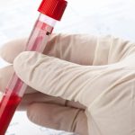 Kaplan Medical Center laboratory allegedly took patients’ blood samples without consent