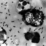 Employee of Russian plague institute dies of suspected pneumonic infection, Trump offers help