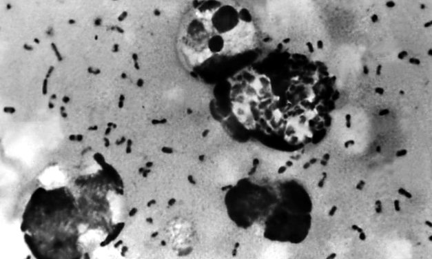 Employee of Russian plague institute dies of suspected pneumonic infection, Trump offers help