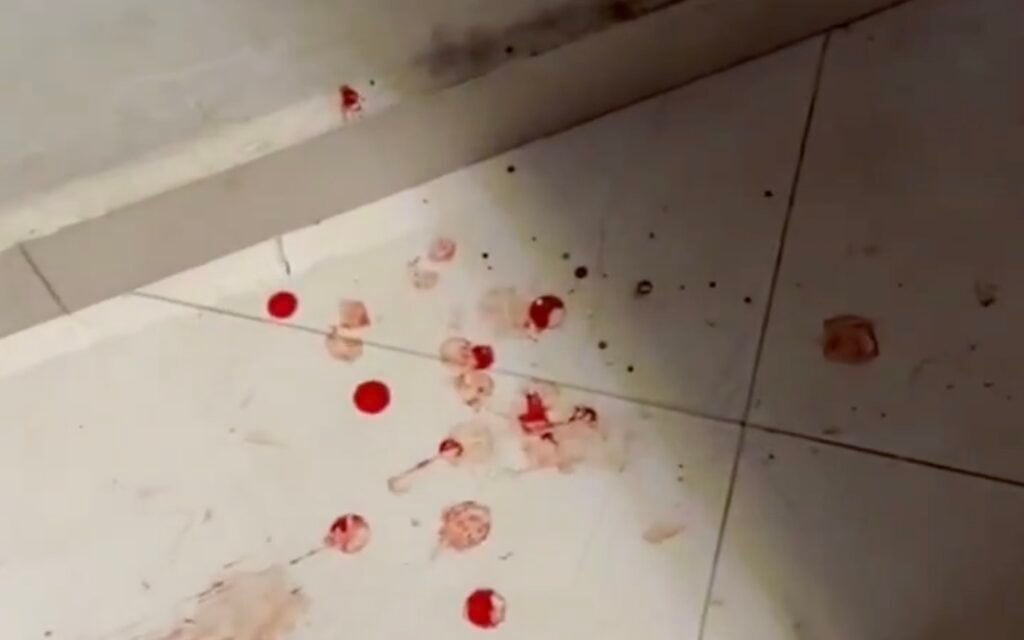 Palestinian says settlers posing as IDF beat him, wife, teen daughters in their home